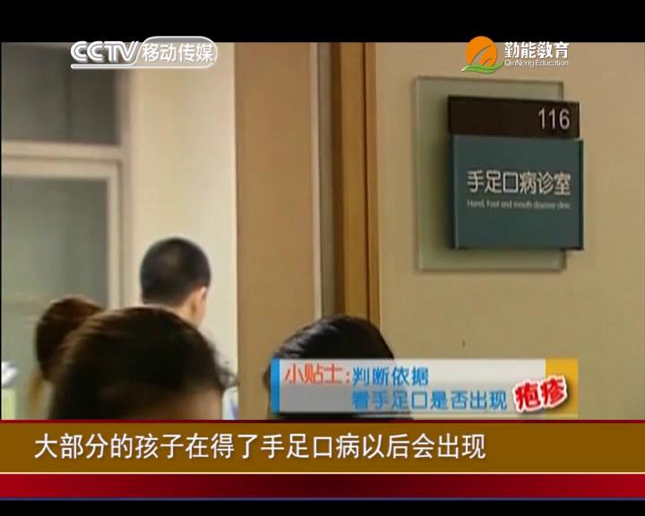 当心手足口病卷土重来
