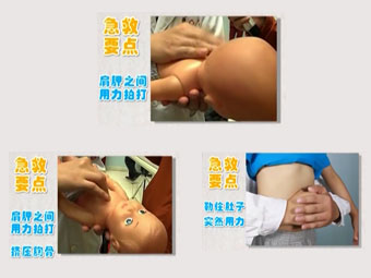 婴幼儿异物卡喉急救办法
